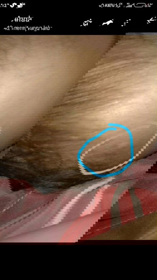 Bintik kecil berair kya bekas kena minyak