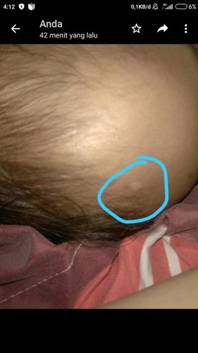 Bintik kecil berair kya bekas kena minyak