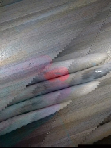 Rusty smelling Discharge after IUD insertion