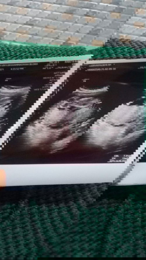 HPL ( Hari perkiraan lahir )