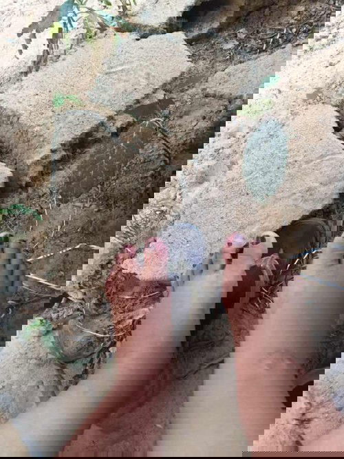 เท้าบวมมาก 27w+1