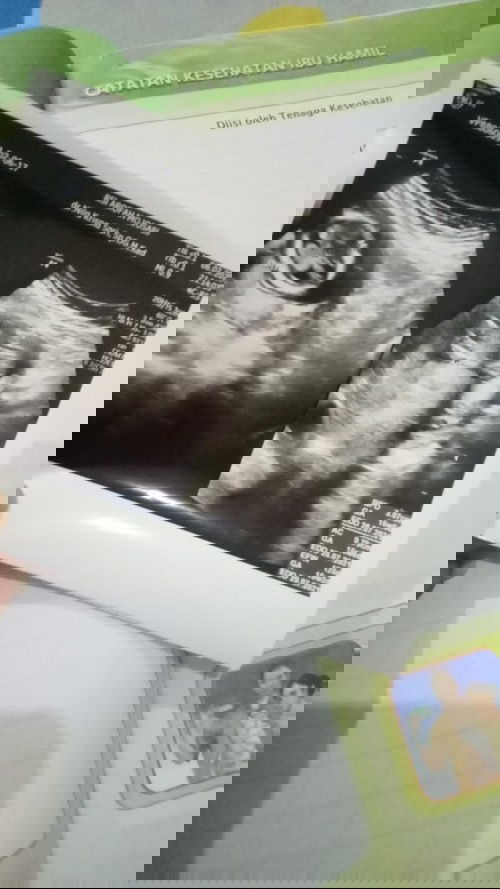 Mengetahui seputar kehamilan saya dan memantau perkembangan janin saya dalam kandungan agar sehat...