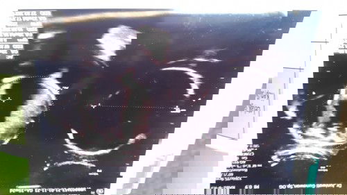 Bagaimana cara mengembalikan posisi bayi sungsang 9 bulan