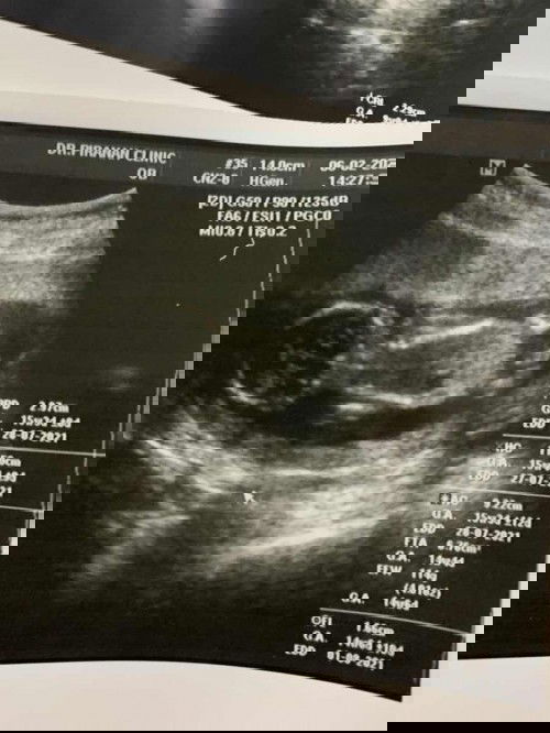 ช่วยดูเพศให้หน่อยค่ะ