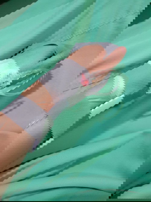 1cm open cervix at 30weeks