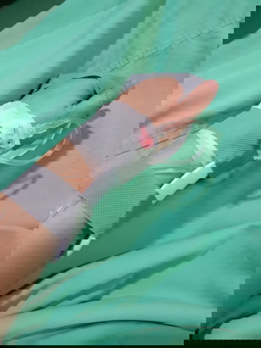 1cm open cervix at 30weeks