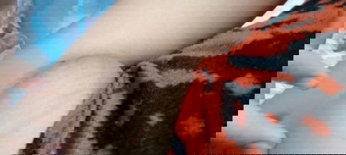 ขอถามหน่อยค่ะหลังคลอดลูกมามีตุ๋มใต้รักแร้มันคือตุ๋มอะไรค่ะ