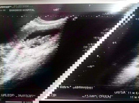 3เดือนค่ะ ตอนนี้เข้า4เดือนแล้วค่ะ