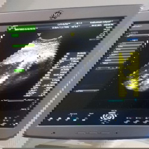 นั่นใช่หน้าน้องรึป่าวคะ !?