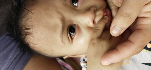 mata berdarah didalam😢😢