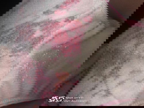 Normal po ba ito 9 months preggy po ako😔