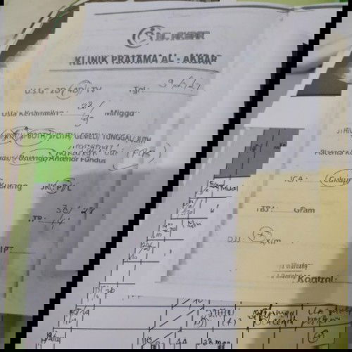 Ngeflek Plasenta udah deket jalan lahir