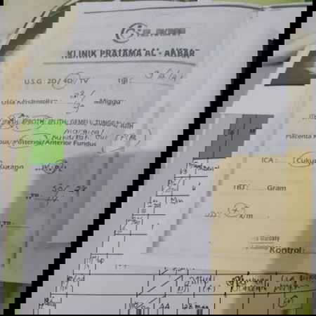 Ngeflek Plasenta udah deket jalan lahir