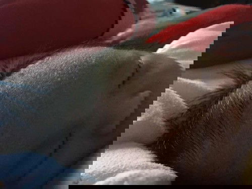 Kulit bagian dahi menebal dan ada bintik seperti berisi air