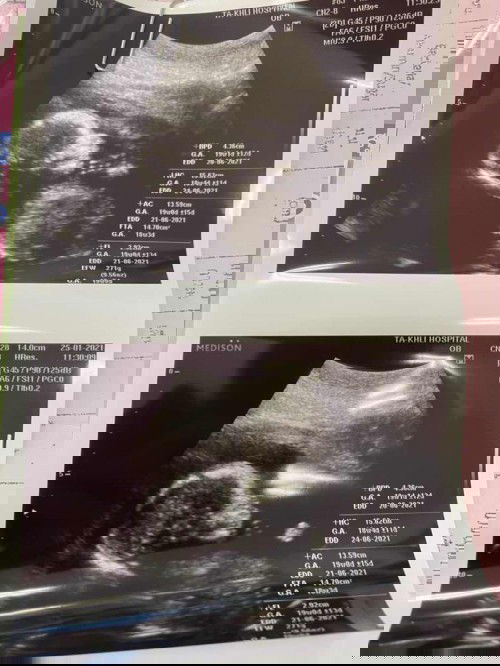 ช่วยตั้งชื่อเล่นลูกสาวหน่อยค่ะ พ่อชื่อแบล๊คแฮ้ม แม่ชื่อหนามเตย อยากให้ชื่อลูกสาว2พยางค์ ทีม มิถุนายน 🎉🥳🤰🏻🙏🏻