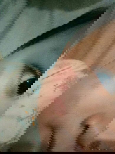 Merah merah pada bayi 8bulan