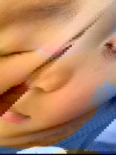 ใครเคยเป็นบ้างคะ