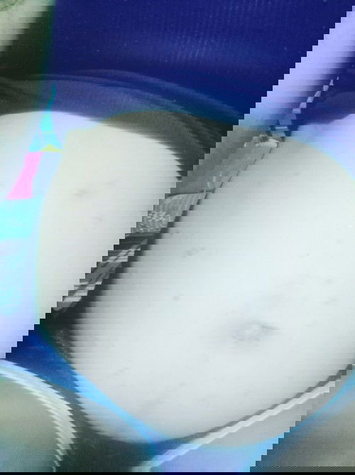 Anu po kaya to sobrang kati nya po pag kinamot parang nag rarashes pls help po..