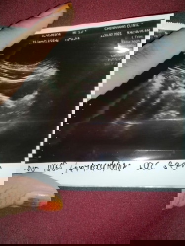 First baby 6w scan tapi tak nampak 😔