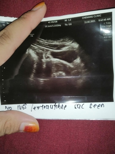 First baby 6w scan tapi tak nampak 😔