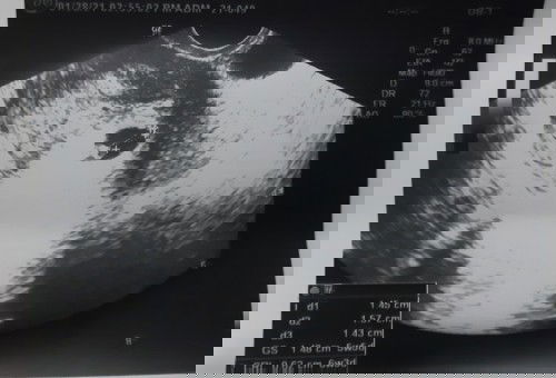 SANA PO MAY MAKASAGOT SA TANONG KO PATULONG NAMAN PO. NAGULUHAN NA PO AKO.😫