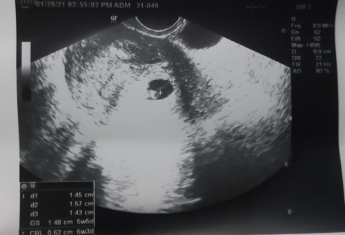 SANA PO MAY MAKASAGOT SA TANONG KO PATULONG NAMAN PO. NAGULUHAN NA PO AKO.😫