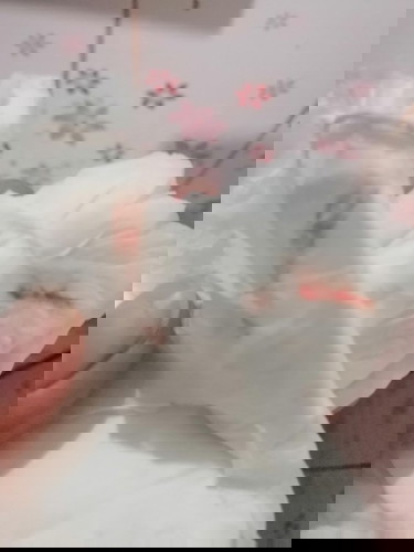 ทรมานมากกับริดสีดวงตอนตั้งครรภ์