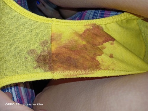 FTM/EBF/5 MONTHS Postpartum