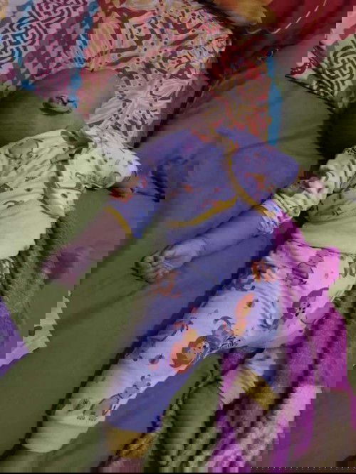 Posisi kepala bayi saat tidur