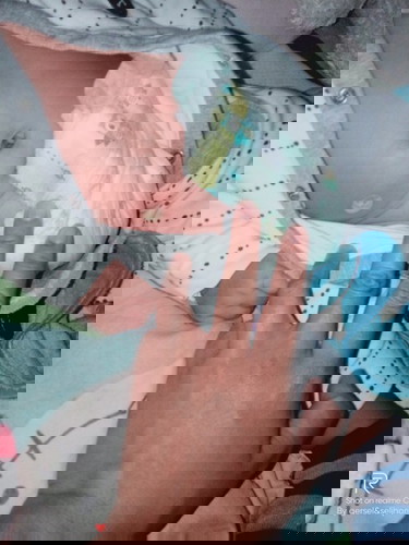 kagat vah to ng langgam oh anu kaya to worried🥺