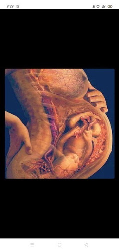 Ask ko lang po. Nagkakamali po ba ang ultrasound sa month ng baby?