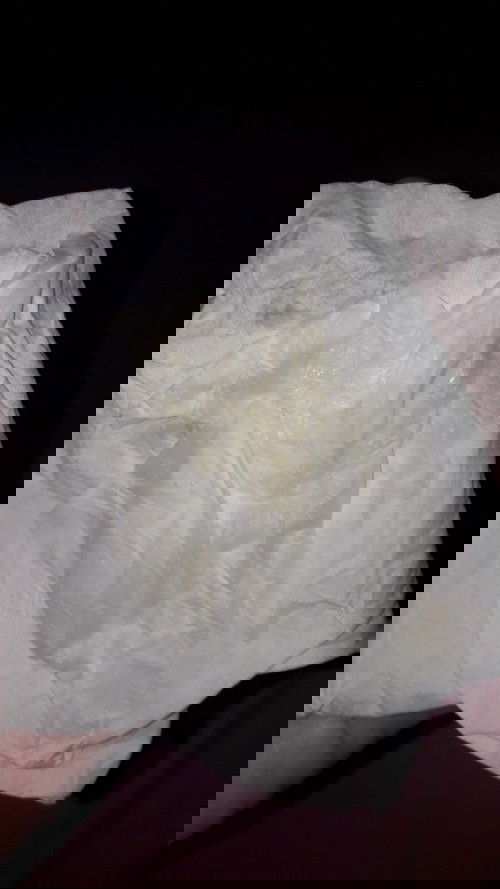 Keputihan berwarna hijau