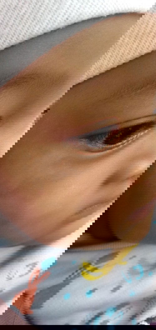 Wajah bayi bintik putih