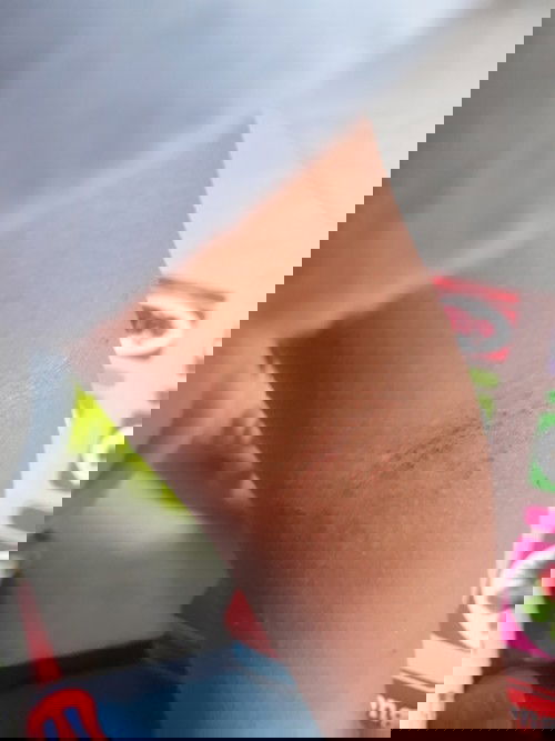 Gatal di lekukan lengan