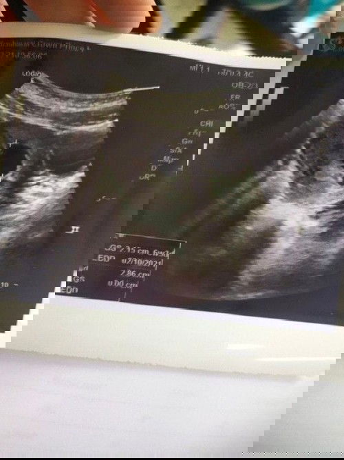 มีแม่ๆคนใหนไปอัลตร้าซาวด์ตอน6สัปดาห์บ้างคะ