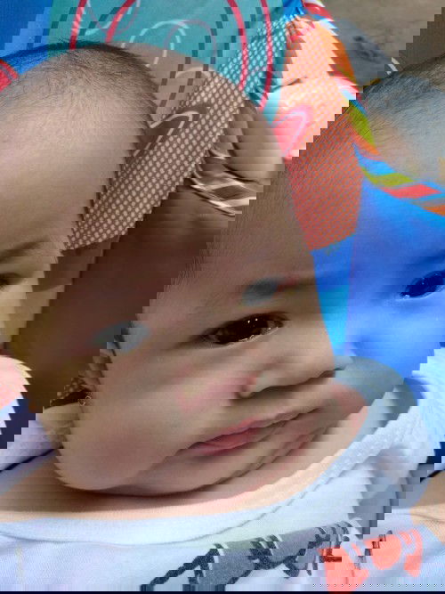 Naranasan din ba ng baby nyo na magmuta? Baby ko nagsimula magmuta nung 2months sya, mag 3 months na