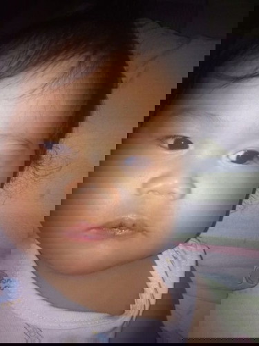 bakit kaya po ganito lips ni lo ko..dry at nagsusugat... suggestoon po anu gamot..thanks po