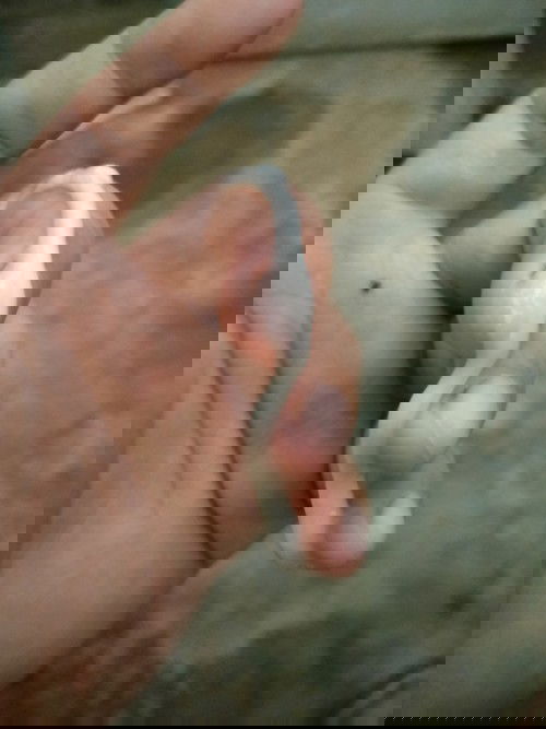 มูกสีขาวเหนียว