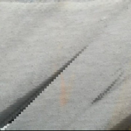 Brown discharge