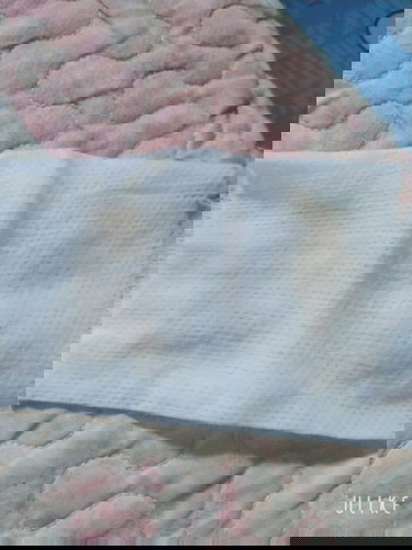 มันคืออะไร