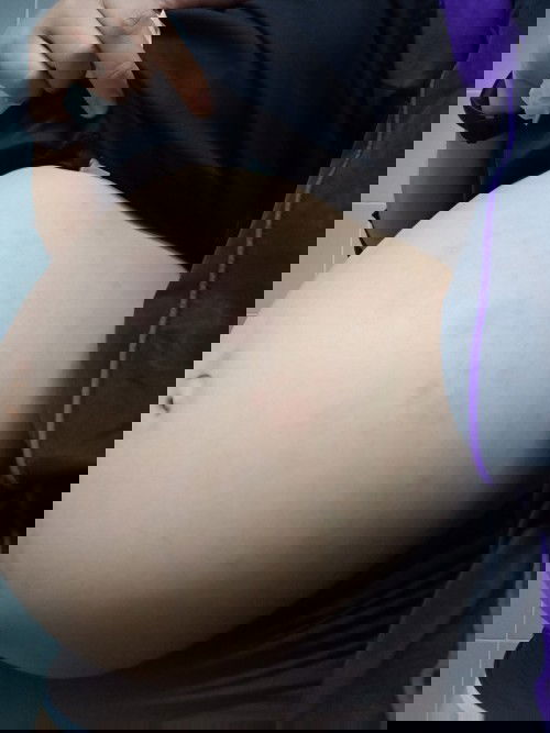 36wkแล้วค่าา เริ่มมีอาการคันและผื่นแดงๆที่ท้อง มีแม่บ้านไหนเป็นบ้างไหมคะ 😊