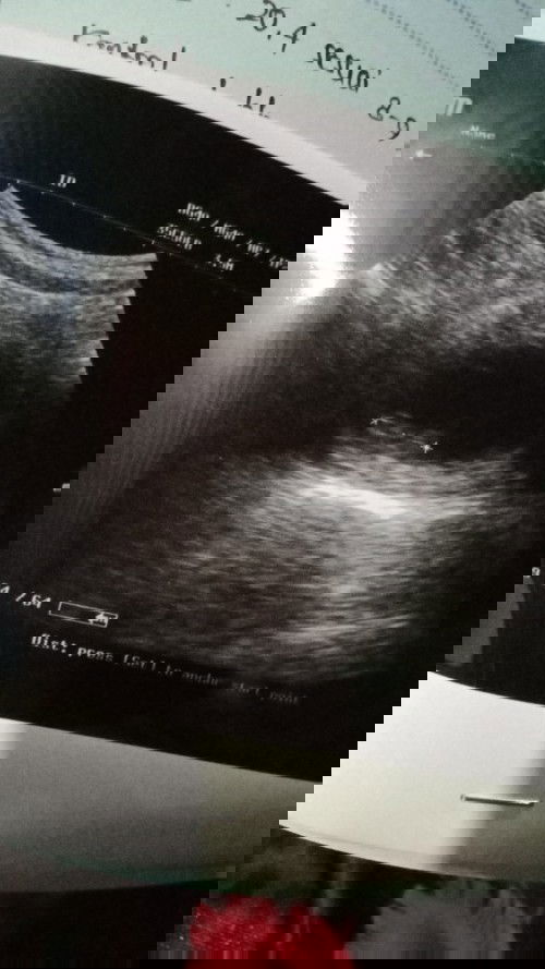 Kebahagian seorang wanita