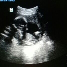 Hasil USG kemarin pas hari selasa