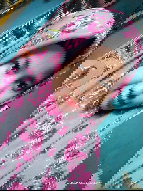 Buah dada sering gatel