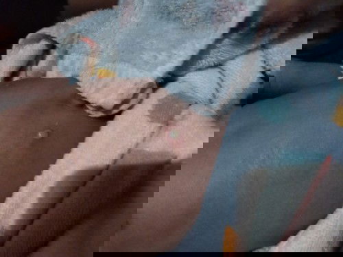 Bentol diperut benanah..