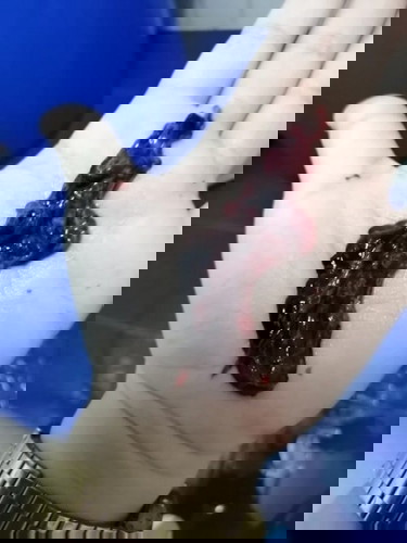 แชร์ประสบการณ์หลังแท้ง