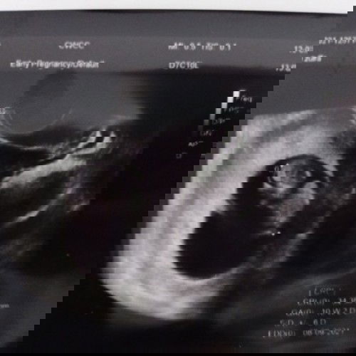 MasyaAllah Tabarakallah