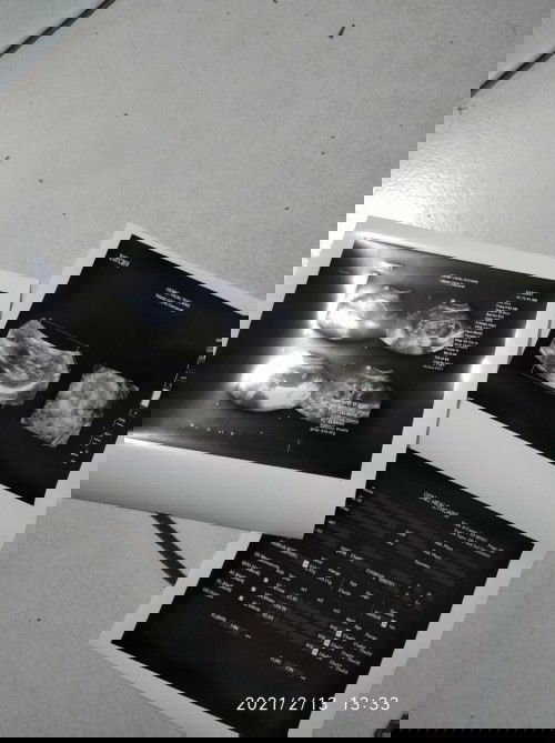 Minta Saran Bunda semua