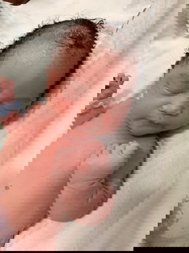 ผ่าคลอดฉุกเฉิน 40+4 d 11 ก.พ.64