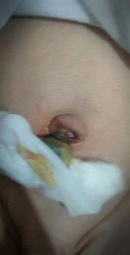 Need advice Po
